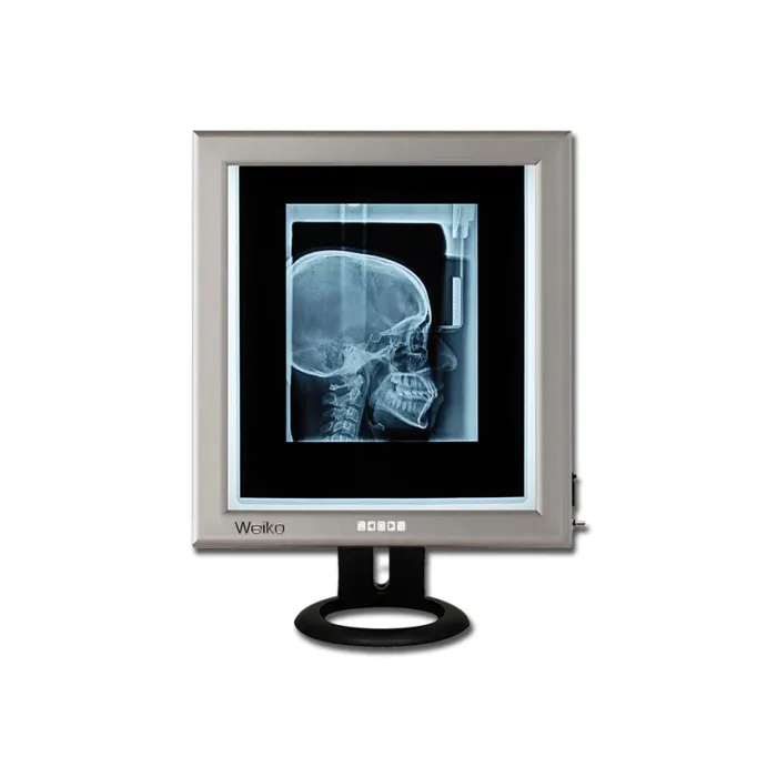 Negatoscop iluminat LED ultra slim 42x36 cm